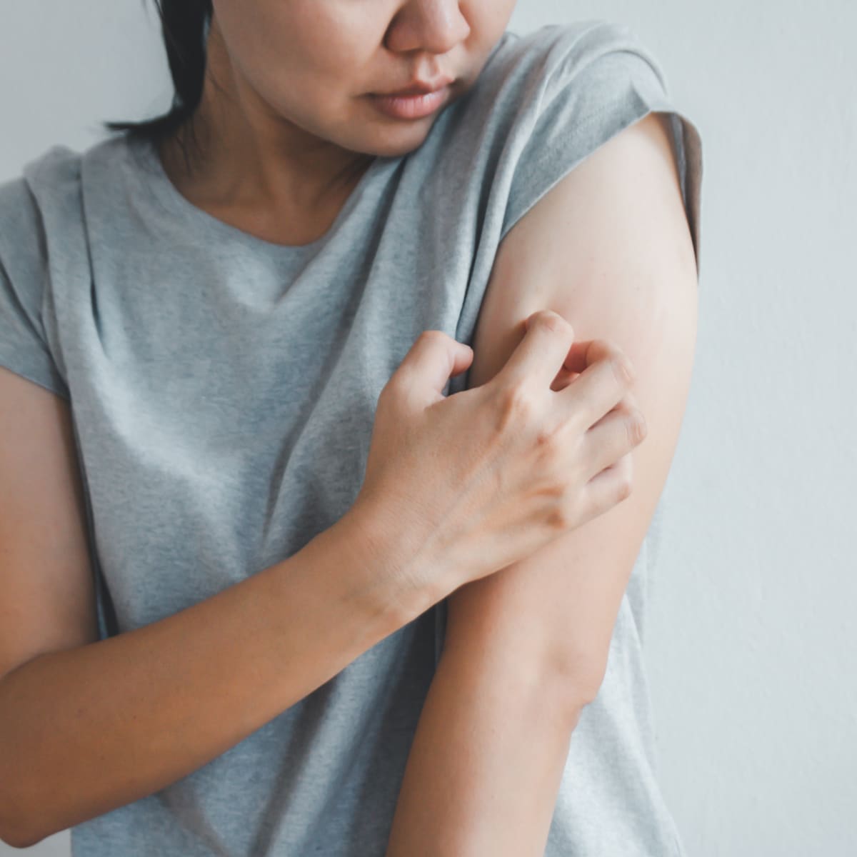 Solutions to Problem Itching - The Arthritis Connection