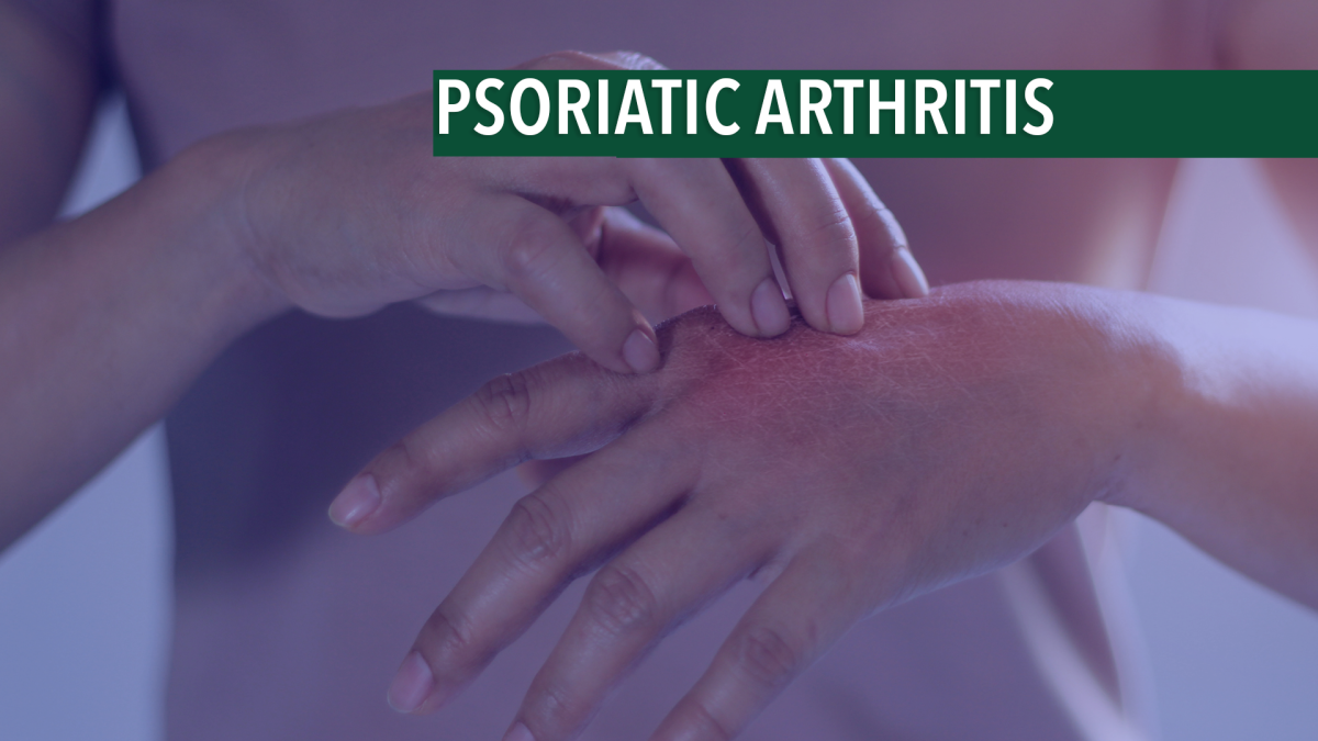 Overview Of Psoriatic Arthritis The Arthritis Connection